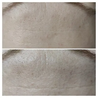 SK SmoothSkin Suwałki